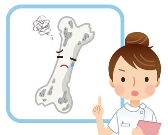 骨粗しょう症