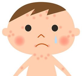 アトピー性皮膚炎